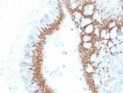 SATB2 Antibody (SATB2/4374R) - Azide and BSA Free, Novus Biologicals 100